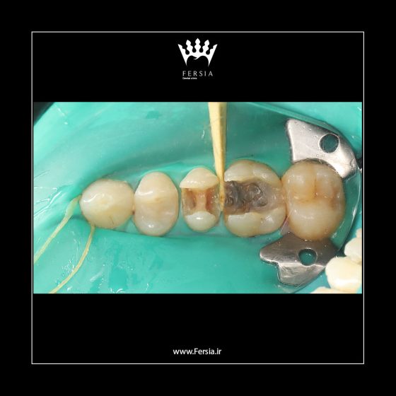 رابردم جهت ایزولیشن